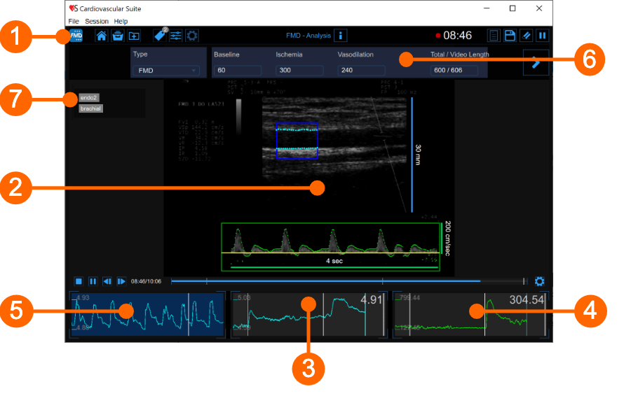 cvs_main_FMDanalysis_gliffy_EN