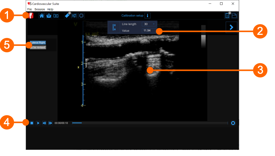 cvs_main_singleImage_gliffy_EN