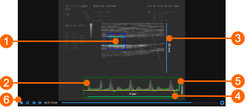 cvs_videoWindow_analysisFMD_gliffy
