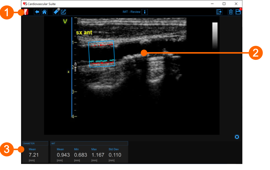 cvs_IMTreview_gliffy_EN