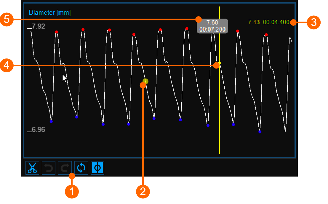 cvs_diameterChart_cineloopReview_gliffy_EN