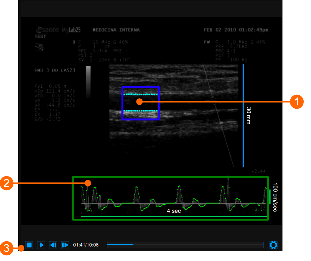 cvs_videoWindow_reviewFMD_gliffy_EN