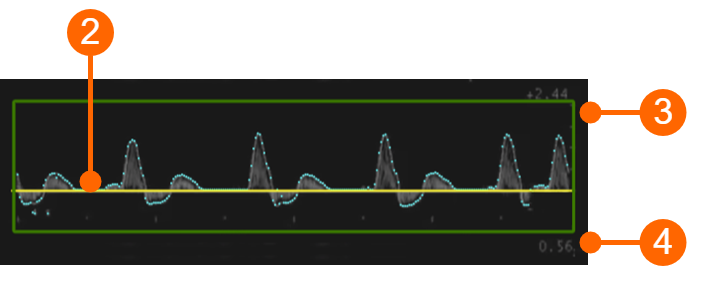 cvs_setupDuplex_doppler_gliffy
