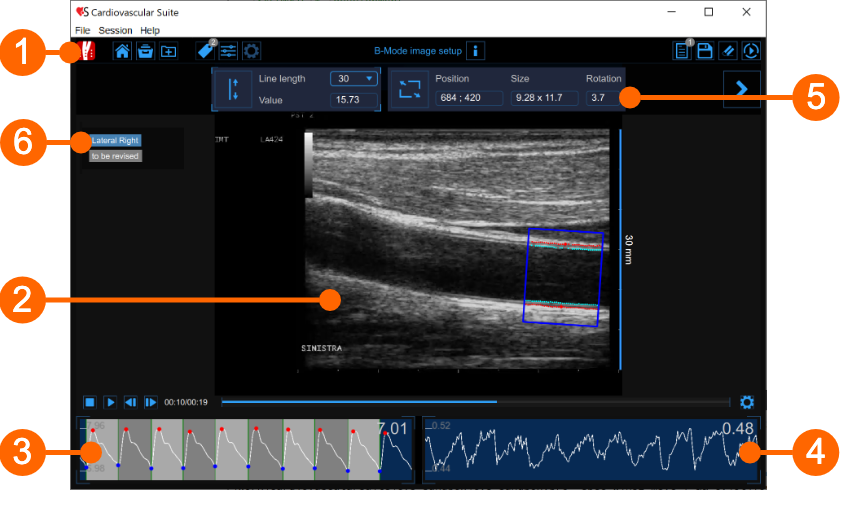 cvs_cineloop_analysis_gliffy_EN