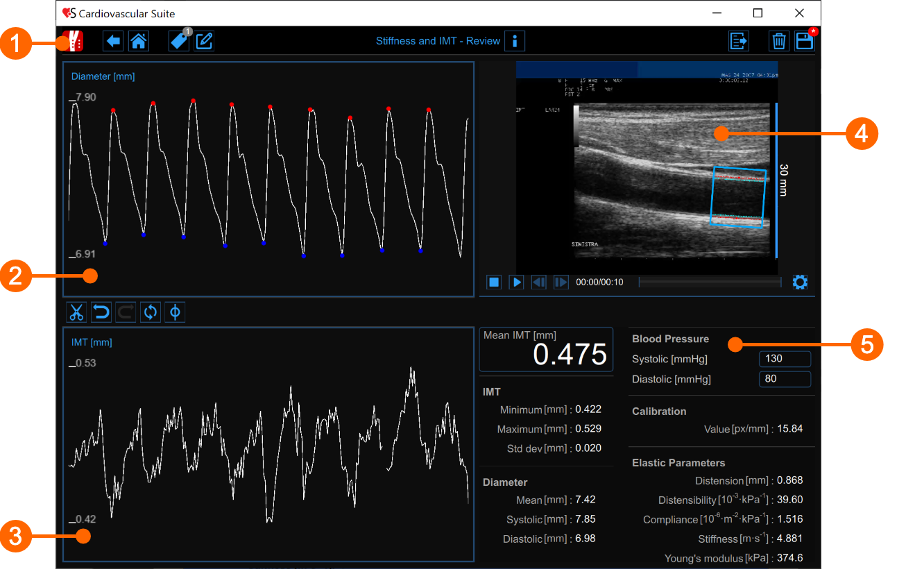 cvs_main_cineloopReview_gliffy_EN