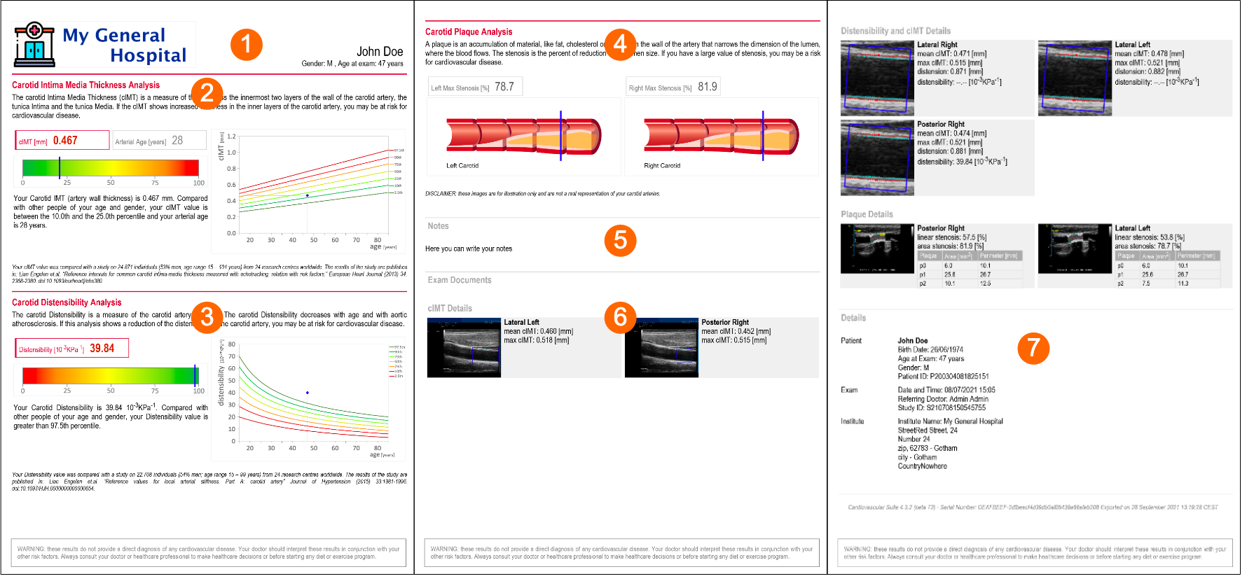 CarotidStudyReport