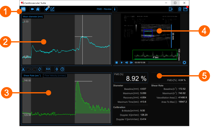 cvs_main_reviewFMD_gliffy_EN
