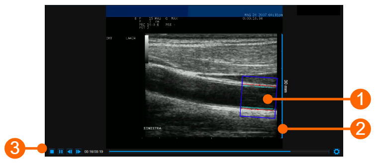 cvs_videoWindow_cineloopAnalysis_gliffy