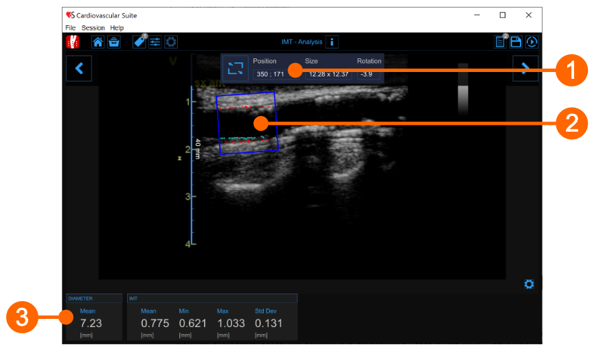 cvs_IMTanalysis_singleImage_gliffy_EN