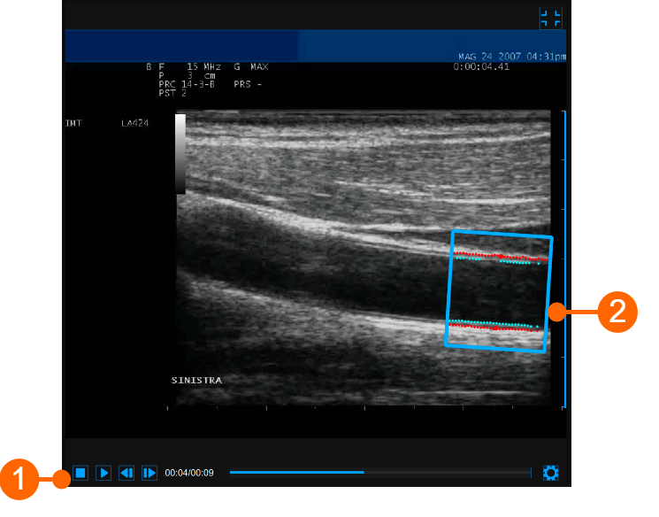 cvs_videoWindow_cineloopReview_gliffy_EN
