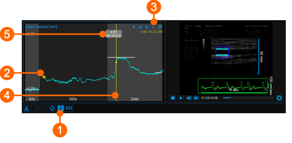 cvs_meanDiameterChart_cursor_reviewFMD_gliffy_EN
